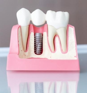 Endodonzia