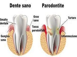 Parodontologia